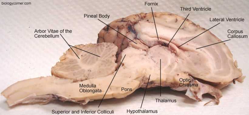 Dissecting A Sheep'S Brain in Sheep Brain Dissection Worksheet